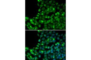 Immunofluorescence analysis of U20S cell using MGMT antibody. (MGMT anticorps  (AA 1-207))