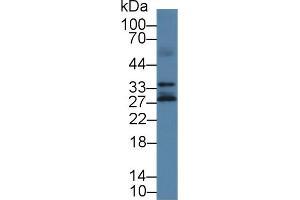 Detection of KLK14 in Human Lung lysate using Polyclonal Antibody to Kallikrein 14 (KLK14) (Kallikrein 14 anticorps  (AA 36-267))