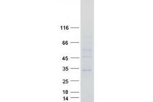 CLN6 Protein (Myc-DYKDDDDK Tag)
