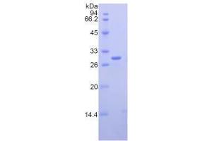 SDS-PAGE analysis of Mouse Nucleolin Protein.