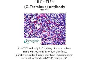 Image no. 1 for anti-tyrosine Kinase with Immunoglobulin-Like and EGF-Like Domains 1 (TIE1) (C-Term) antibody (ABIN1740068) (TIE1 anticorps  (C-Term))