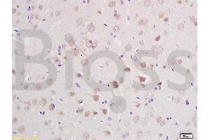 Formalin-fixed and paraffin embedded rat brain labeled with Anti-CLCN3 Polyclonal Antibody, Unconjugated (ABIN1386131) at 1:200 followed by conjugation to the secondary antibody and DAB staining (CLCN3 anticorps  (AA 81-180))