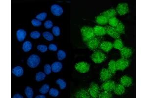 anti-LSM2 Homolog, U6 Small Nuclear RNA Associated (LSM2) (C-Term) antibody