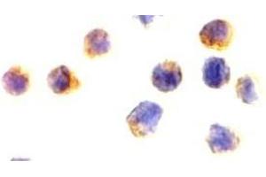 Immunocytochemical staining of AIF in Jurkat cells with AIF(NT) antibody at 2 μg/ml. (AIF anticorps)