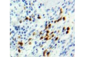 Used in DAB staining on fromalin fixed paraffin-embedded Spleen tissue (Retinoblastoma 1 anticorps  (AA 639-778))