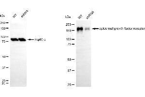 Western blotting analysis using epidermal growth factor receptor antibody (ABIN7798473). (EGFR anticorps)