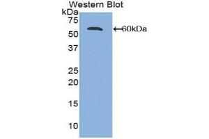 Western Blotting (WB) image for anti-Activated Leukocyte Cell Adhesion Molecule (ALCAM) (AA 28-527) antibody (ABIN1857960)