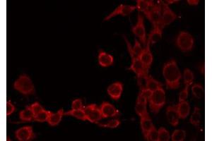 ABIN6268754 staining HeLa by IF/ICC. (TOMM20 anticorps  (Internal Region))
