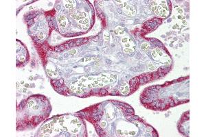 Anti-TFAM antibody IHC of human placenta. (TFAM anticorps  (AA 151-200))