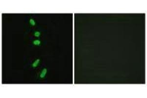 Immunofluorescence analysis of HeLa cells, using SF1 (Ab-82) antibody.