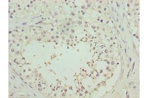 Immunohistochemistry of paraffin-embedded human testis tissue using ABIN7166851 at dilution of 1:100 (RHPN1-AS1 anticorps  (AA 1-59))