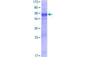 Image no. 1 for Solute Carrier Family 39 (Metal Ion Transporter), Member 11 (SLC39A11) (AA 1-335) protein (GST tag) (ABIN1320426)