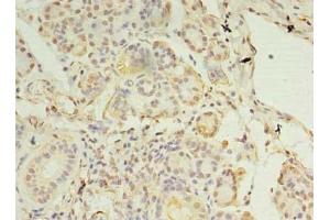 Immunohistochemistry of paraffin-embedded human pancreatic tissue using ABIN7146318 at dilution of 1:100 (CCDC109B anticorps  (Regulatory Subunit))