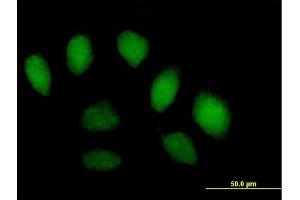 Immunofluorescence of purified MaxPab antibody to SFMBT1 on HeLa cell. (SFMBT1 anticorps  (AA 1-866))
