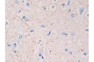 Detection of KISS1 in Human Cerebrum Tissue using Polyclonal Antibody to Kisspeptin 1 (KISS1)