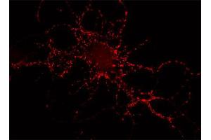 Indirect immunostaining of rat hippocampus neurons (dilution 1 : 500). (Piccolo anticorps  (AA 2011-2350))