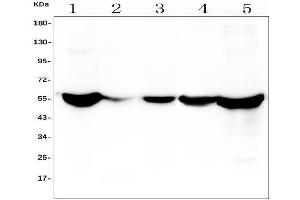 Western blot analysis of ALDH2 using anti-ALDH2 antibody (ABIN7603107). (ALDH2 anticorps  (N-Term))