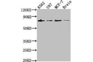Western Blot Positive WB detected in: K562 whole cell lysate, U87 whole cell lysate, MCF-7 whole cell lysate, Rat brain tissue All lanes: LMNA antibody at 1:2000 Secondary Goat polyclonal to rabbit IgG at 1/50000 dilution Predicted band size: 75, 66, 71, 64, 63, 70 kDa Observed band size: 75 kDa (Lamin A/C anticorps  (AA 385-572))