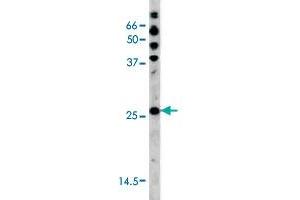 The CDKN1B (phospho S178) polyclonal antibody  is used in Western blot to detect Phospho-CDKN1B-S178 in HL-60 tissue lysate (CDKN1B anticorps  (pSer178))