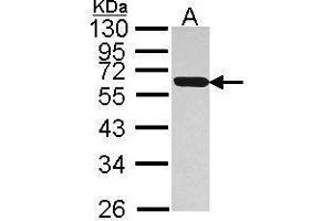 WB Image Sample (30 ug of whole cell lysate) A: Hep G2 , 12% SDS PAGE antibody diluted at 1:1000 (PDIA5 anticorps)