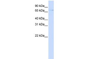 WB Suggested Anti-ZNF324 Antibody Titration:  0.