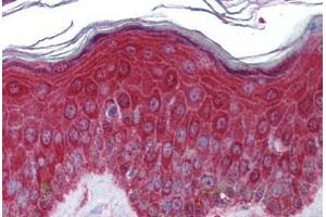 Human Skin: Formalin-Fixed, Paraffin-Embedded (FFPE)