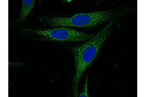 Indirect immunostaining of HELA cells (dilution 1 : 100; green). (Syntaxin 4 anticorps  (Cytoplasmic Domain))