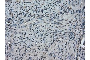 Immunohistochemical staining of paraffin-embedded Ovary tissue using anti-TMEM100mouse monoclonal antibody. (TMEM100 anticorps)
