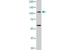 PKN1 MaxPab rabbit polyclonal antibody. (PKN1 anticorps  (AA 1-942))