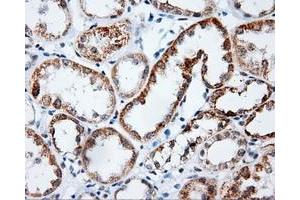 Immunohistochemical staining of paraffin-embedded Kidney tissue using anti-PLEK mouse monoclonal antibody. (Pleckstrin anticorps)