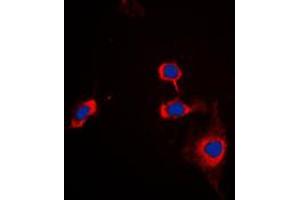 Immunofluorescent analysis of CD172a staining in THP1 cells. (SIRPA anticorps  (C-Term))