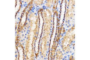 Immunohistochemistry of paraffin-embedded Rat kidney using Mitofusin 2 Rabbit pAb (ABIN6133825, ABIN6143800, ABIN6143803 and ABIN6216518) at dilution of 1:100 (40x lens).