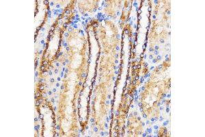 Immunohistochemistry of paraffin-embedded Rat kidney using Mitofusin 2 Rabbit pAb (ABIN6133825, ABIN6143800, ABIN6143803 and ABIN6216518) at dilution of 1:100 (40x lens). (MFN2 anticorps  (AA 500-600))