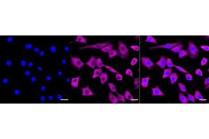 anti-Lectin, Galactoside-Binding, Soluble, 1 (LGALS1) antibody
