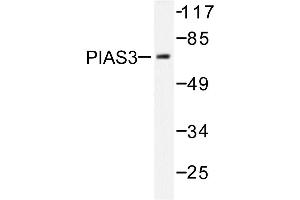 Image no. 1 for anti-Protein Inhibitor of Activated STAT, 3 (PIAS3) antibody (ABIN271953)