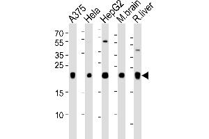 Western blot analysis of lysates from A375, Hela, HepG2 cell line, mouse brain and rat liver tissue lysate(from left to right), using ITPA Antibody at 1:1000 at each lane. (ITPA anticorps  (N-Term))