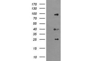 Image no. 1 for anti-Ubiquitin Specific Peptidase 16 (USP16) (AA 137-466) antibody (ABIN1490917) (USP16 anticorps  (AA 137-466))