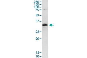 CENPH MaxPab rabbit polyclonal antibody. (CENPH anticorps  (AA 1-247))