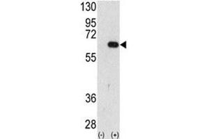 Western blot analysis of AMFR antibody and 293 cell lysate (2 ug/lane) either nontransfected (Lane 1) or transiently transfected with the AMFR gene (2).