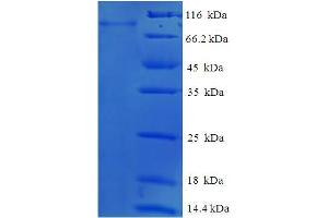 SDS-PAGE (SDS) image for Glucokinase (Hexokinase 4) Regulator (GCKR) (AA 1-625), (full length) protein (His-SUMO Tag) (ABIN5711309)
