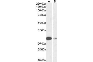 ABIN6391392 (1µg/ml) staining of Mouse (A) and Rat (B) Lung lysate (35µg protein in RIPA buffer).