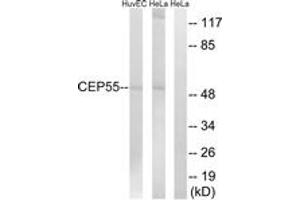 Western blot analysis of extracts from HeLa/HuvEc cells, using CEP55 Antibody. (CEP55 anticorps  (AA 81-130))