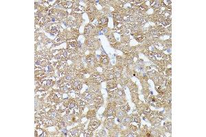 Immunohistochemistry of paraffin-embedded rat liver using CDK5R antibody (ABIN7266235) at dilution of 1:100 (40x lens).