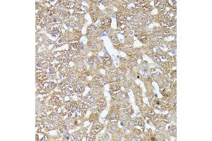 Immunohistochemistry of paraffin-embedded rat liver using CDK5R antibody (ABIN7266235) at dilution of 1:100 (40x lens). (CDK5RAP1 anticorps  (AA 1-350))