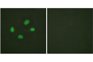Immunofluorescence staining of methanol-fixed HeLa cells using Chk2 (Phospho-Thr383) Antibody.