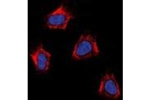 Immunofluorescent analysis of AT1 staining in K562 cells. (AGTR1a anticorps)