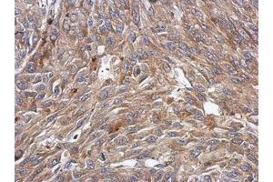 anti-BTB (POZ) Domain-Containing Protein KCTD4 (KCTD4) (AA 1-225) antibody