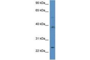 Image no. 1 for anti-Acyl-CoA Thioesterase 9 (Acot9) (AA 356-405) antibody (ABIN6746915)