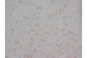 Immunohistochemistry on Paraffin Sections of Rat brain using AP23320PU-N CHRNA1 antibody.