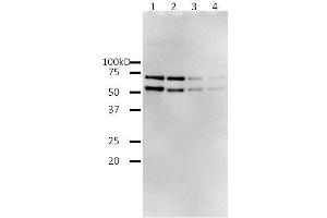 Western Blotting (WB) image for HIV-1 Reverse Transcriptase (HIV1RT) (Active) protein (ABIN2452197) (HIV1RT Protéine)